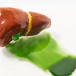 常听说胃食管反流，胆汁反流你知道多少？