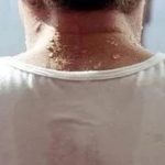 出汗虽是正常生理现象？此类人群要留意因出汗引发的意外