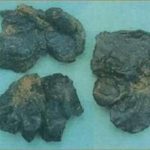 獭肝副作用 獭肝的禁忌2021