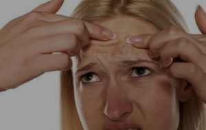 脸上长痘痘怎么调理